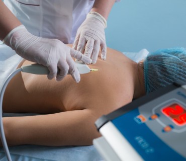 Карбокситерапия