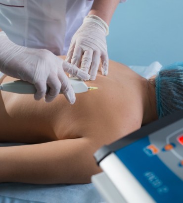 Карбокситерапия