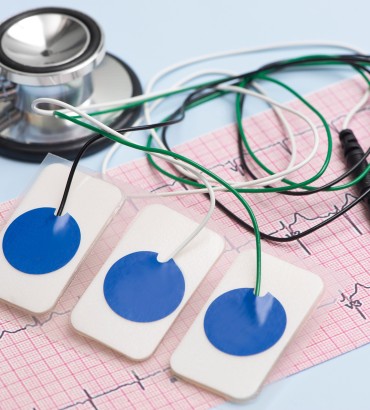 Функциональная диагностика